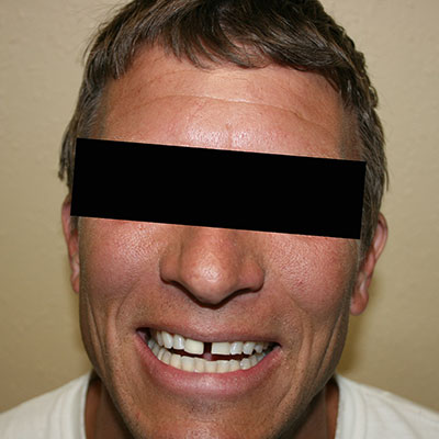 Dentist San Clemente Ca - Gallery | Dentist in San Clemente, CA - 92673, 92674, and 92675 we would love to be your dentist.